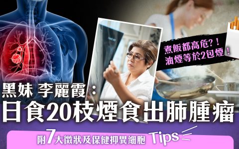 肺腫瘤